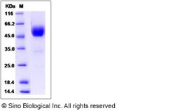 Sino Biological Recombinant Human SIGIRR Protein (hFc Tag), Quantity: Each