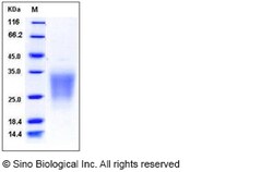 Sino Biological Human SIGIRR / TIR8 Protein (His Tag) 100ug, Quantity: