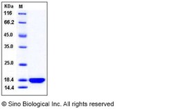 Sino Biological Recombinant Human PDZD11 Protein (His Tag), Quantity: Each
