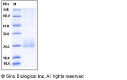 Sino Biological Recombinant Human CD160 Protein (His Tag), Quantity: Each