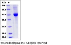 Sino Biological Recombinant Human Betacellulin Protein (hFc Tag), Quantity: