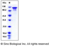 Sino Biological Human STK16 / PKL12 / MPSK Protein (His & NusA Tag) 50ug,