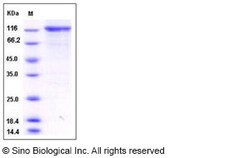 Sino Biological Human TLK1 / PKU-beta Protein (His & GST Tag) 50ug, Quantity: