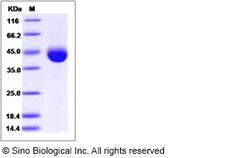 Sino Biological Recombinant Human COL9A1 Protein (His Tag), Quantity: Each