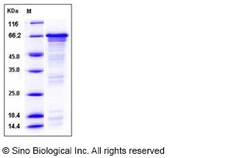 Sino Biological Human HSF1 / HSTF1 Protein (His Tag) 100ug, Quantity: Each
