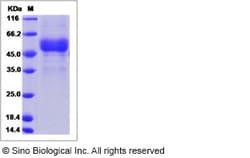 Sino Biological Recombinant Human CLEC2B Protein (hFc Tag), Quantity: Each