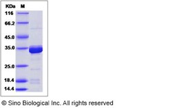 Sino Biological Human B3GAT3 / GLCATI Protein (His Tag) 20ug, Quantity: