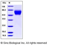 Sino Biological Recombinant Human MICA Protein (ECD, His Tag), MICA*018,