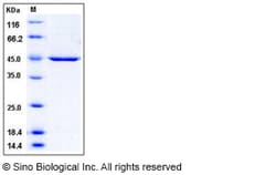 Sino Biological Human PDK-1 Protein (His Tag) 50ug, Quantity: Each of 1