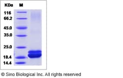 Sino Biological Human IFN-alpha / IFNA1 / IFN Protein (His Tag) 100ug,