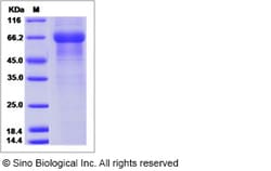 Sino Biological Recombinant Human KLK15 Protein (hFc Tag), Quantity: Each