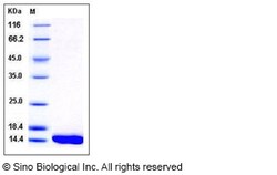 Sino Biological Recombinant Human L-FABP Protein (His Tag), Quantity: Each