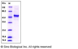 Sino Biological Recombinant Human Casein Kinase 1 gamma 2 Protein (His
