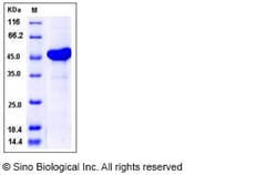 Sino Biological Recombinant Human AK3L1 Protein (His & GST Tag), Quantity: