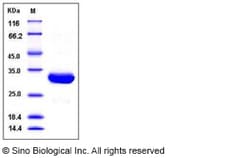 Sino Biological Human SCGN / Secretagogin Protein (His Tag) 100ug, Quantity: