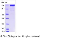 Sino Biological Human C6 / complement component 6 Protein (His Tag) 100ug,