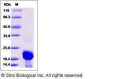 Sino Biological Human Calmodulin 2 / CALM2 Protein (His Tag) 100ug, Quantity: