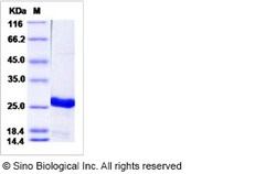 Sino Biological Recombinant Human UBE2T Protein (His Tag), HPLC-verified,