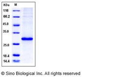 Sino Biological Recombinant Human RhoA Protein (His Tag), Quantity: Each