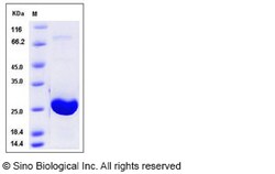 Sino Biological Recombinant Human Adenylate Kinase 1 Protein (His Tag),