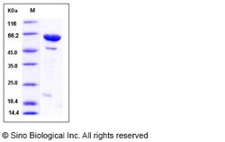 Sino Biological Human DUSP14 / MKP-6 Protein (His & MBP Tag) 100ug, Quantity: