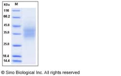 Sino Biological Recombinant Human CD300A/LMIR1 Protein (His Tag), Quantity: