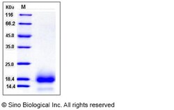 Sino Biological Human CD59 Protein (His Tag) 100ug, Quantity: Each of 1