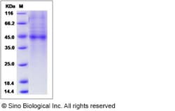 Sino Biological Recombinant Human PLA2G2D Protein (hFc Tag), Quantity: