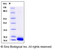 Sino Biological Recombinant Human CALML3 Protein (His Tag), Quantity: Each