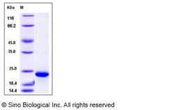 Sino Biological Human FTL / ferritin, light polypeptide Protein (His Tag)