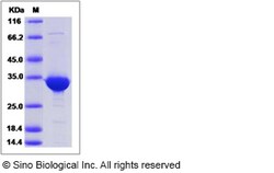 Sino Biological Recombinant Human BVES Protein (GST Tag), Quantity: Each