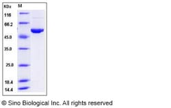 Sino Biological Human ALDH3A1 Protein (His Tag) 50ug, Quantity: Each of