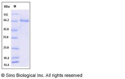 Sino Biological Recombinant Human GLT25D2 Protein (His Tag), Quantity: