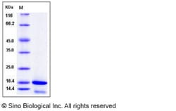 Sino Biological Human CDK2AP2 Protein (His Tag) 100ug, Quantity: Each of