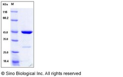 Sino Biological Recombinant Human p19 INK4d Protein (GST Tag), Quantity:
