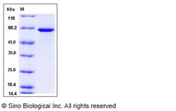 Sino Biological Human GBP1 Protein (His Tag) 100ug, Quantity: Each of 1