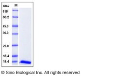 Sino Biological Recombinant Human FABP6 Protein, Quantity: Each of 1
