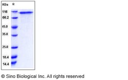 Sino Biological Recombinant Human C1qR1/CD93 Protein (His Tag), HPLC-verified,