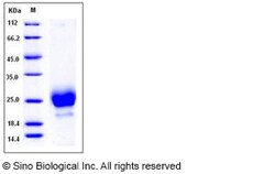 Sino Biological Recombinant Human HE4/WFDC2 Protein (His Tag), HPLC-verified,