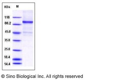 Sino Biological Human ELK1 Protein (His & GST Tag) 100ug, Quantity: Each