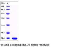 Sino Biological Human LAMTOR2 / ROBLD3 / MAPBPIP Protein (His Tag) 100ug,