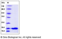 Sino Biological Human UBCH8 / UBE2L6 Protein (His Tag) 100ug, Quantity: