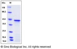 Sino Biological Recombinant Human HOXA1 Protein (His Tag), Quantity: Each