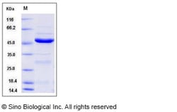 Sino Biological Human NEIL1 Protein (His Tag) 50ug, Quantity: Each of 1