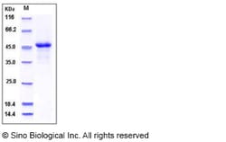 Sino Biological Recombinant Human ILKAP Protein (His Tag), Quantity: Each