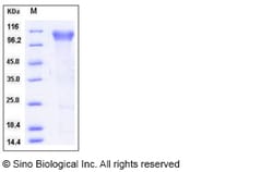 Sino Biological Human BLNK / Ly-57 / SLP-65 Protein (His Tag) 50ug, Quantity: