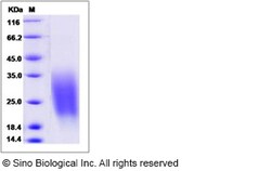 Sino Biological Recombinant Human CREB3L1 Protein (aa 396-519, His Tag),