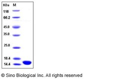 Sino Biological Human ISG15 / G1P2 Protein 1mg, Quantity: Each of 1