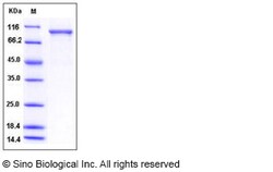 Sino Biological Human USP5 / ISOT Protein (His Tag) 100ug, Quantity: Each