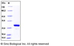 Sino Biological Recombinant Human MAD2L1 Protein (His Tag), Quantity: Each